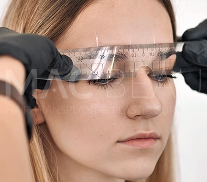 Greffe de Sourcils Anesthésie Sans Aiguille et Technique DHI Sans Rasage